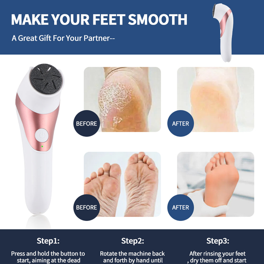 Appareil Électrique Anti-Callosités – Soin des Pieds Professionnel à Domicile